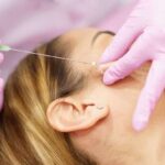 Mulher ganha indenização após ter rosto deformado por fios de rejuvenescimento