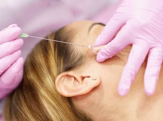 Mulher ganha indenização após ter rosto deformado por fios de rejuvenescimento