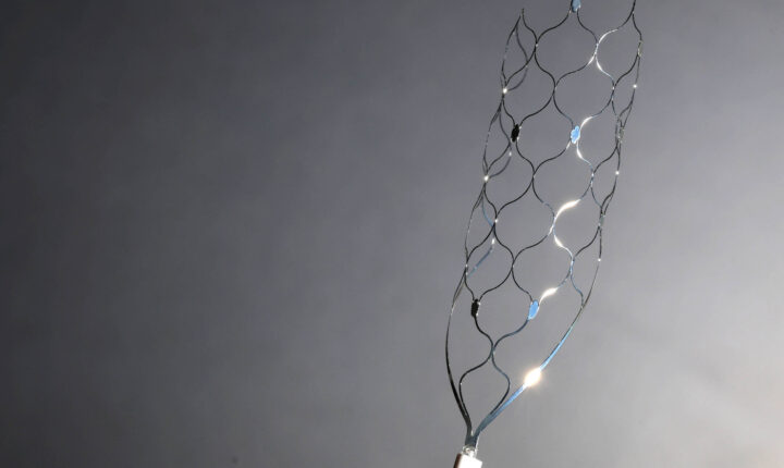 Nova técnica médica permite desobstruir artérias calcificadas sem o uso de stents