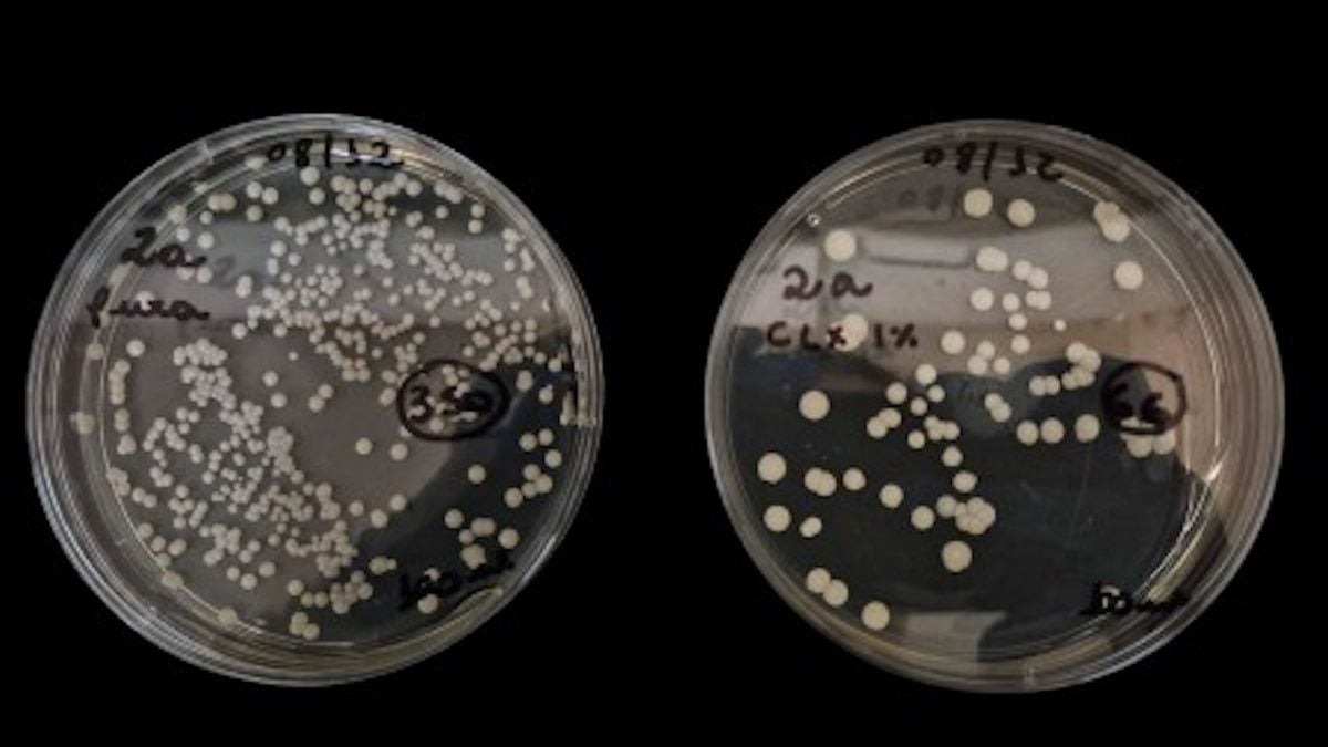 Antisséptico à base de clorexidina combate fungo hospitalar