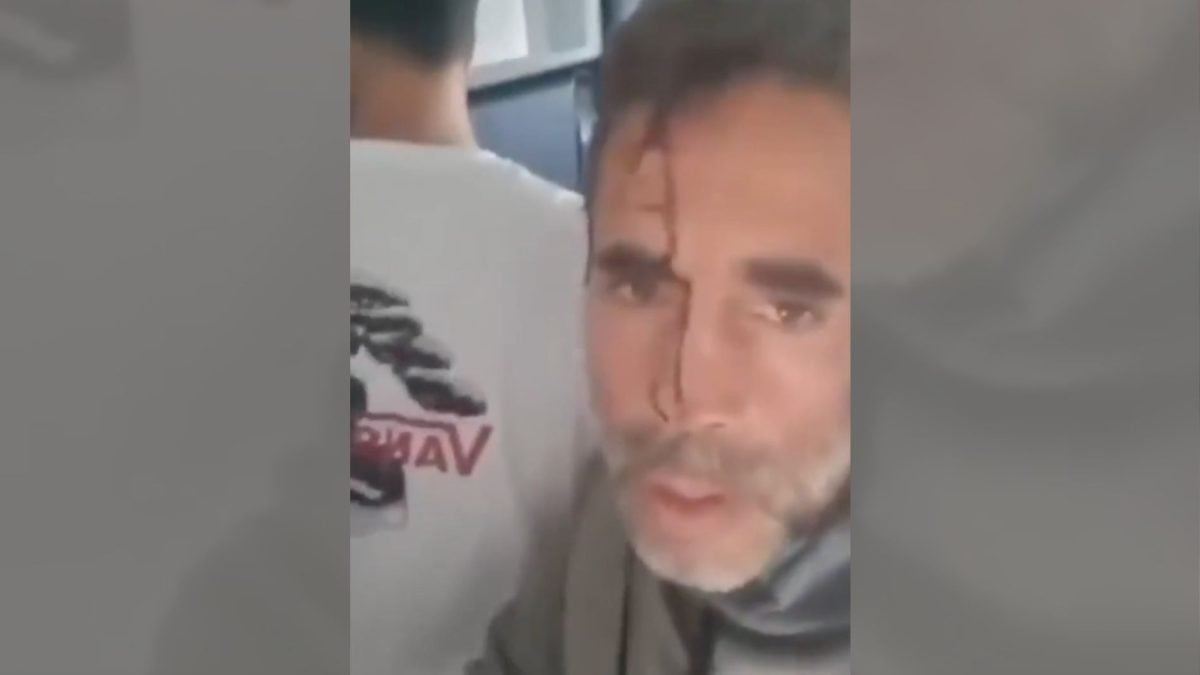Vídeos mostram passageiros socorrendo piloto ferido em voo a Israel