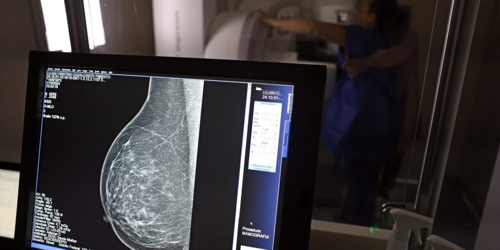 Entidades médicas publicam orientações para evitar recusa de mamografia digital em planos de saúde