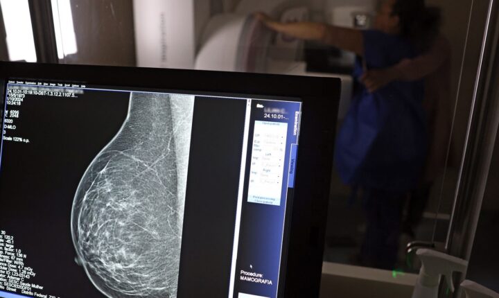 Entidades médicas publicam orientações para evitar recusa de mamografia digital em planos de saúde