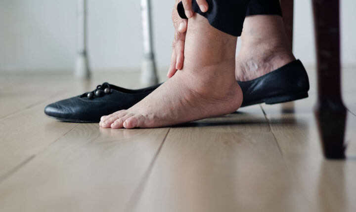 Cicatrização de feridas no diabetes desafia pacientes e impulsiona a ciência