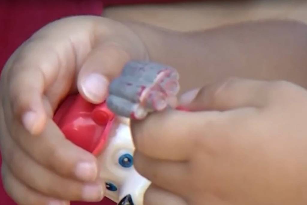 Polícia Civil investiga agressão a criança de 2 anos em creche particular de Belém