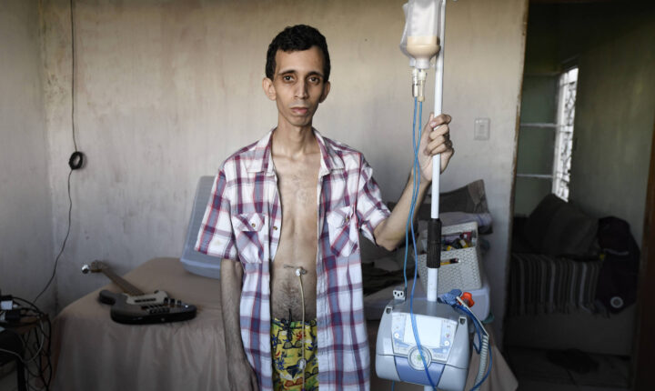 Sem diagnóstico, pacientes com doenças raras passam anos em busca de respostas